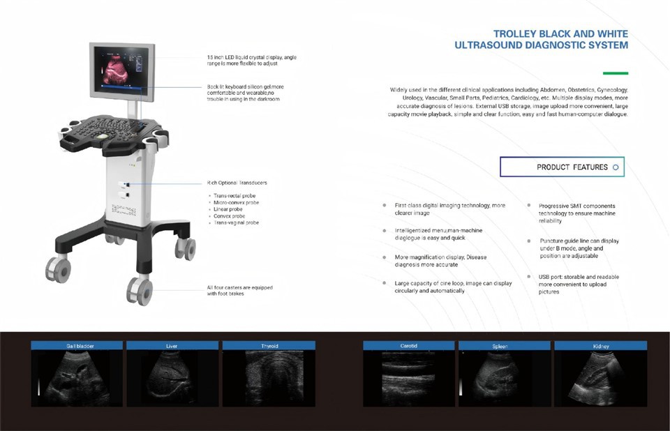 CS009 Handheld Black and White Ultrasound Machine - Trolley-Mounted Full-Digital Diagnostic System (1)