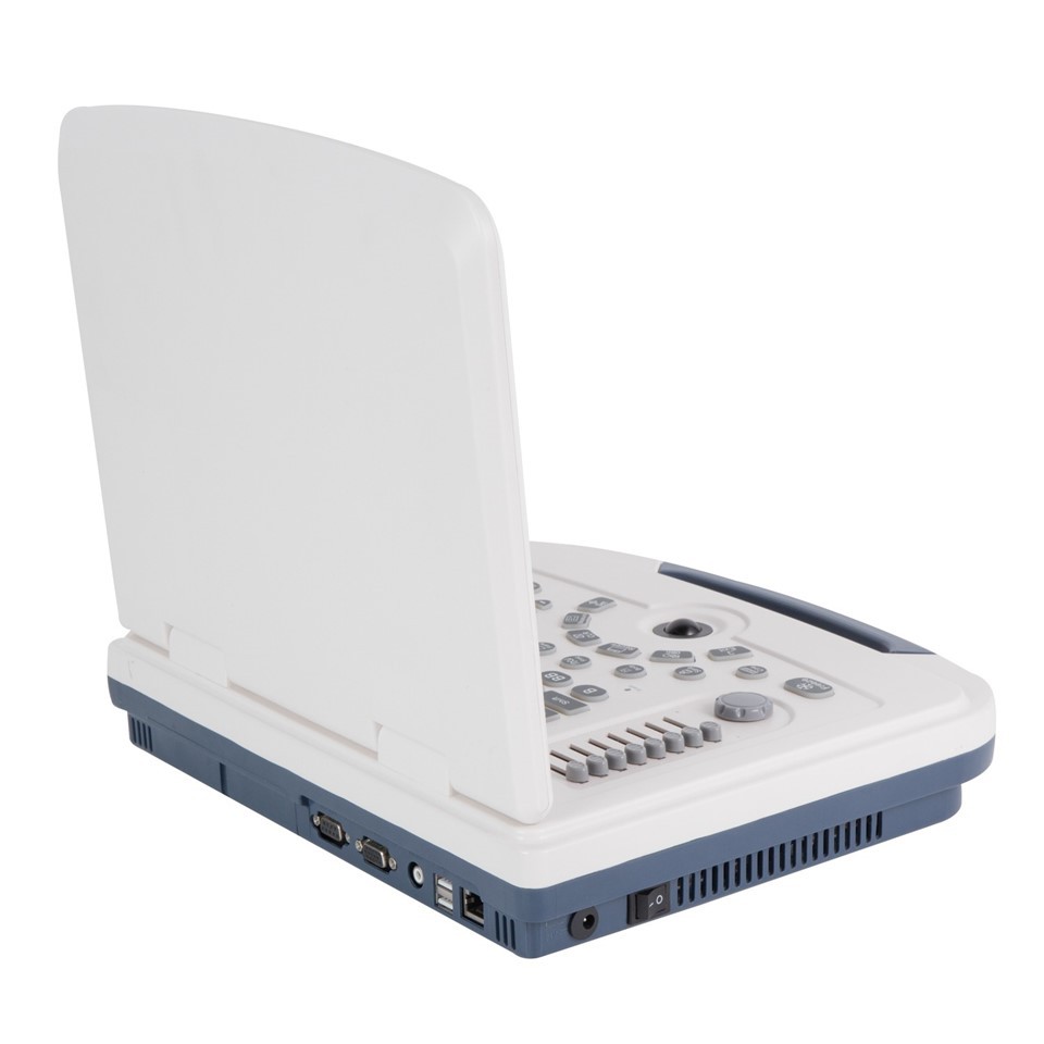 Portable Black-and-White Ultrasound Machine - Laptop-Style Full-Digital Diagnostic System (4)